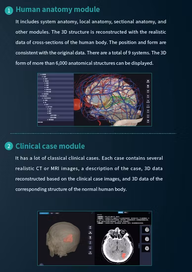 대학을 위한 공장 가격 부검 3D 교육 Anatomage 가상 해부학 해부 테이블